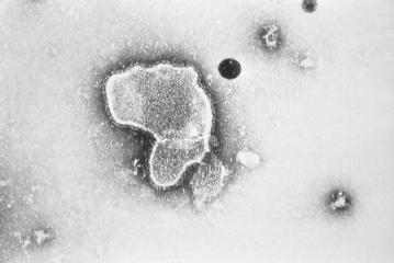 Virus VSR: Esto debes saber de la enfermedad que amenaza con una nueva pandemia